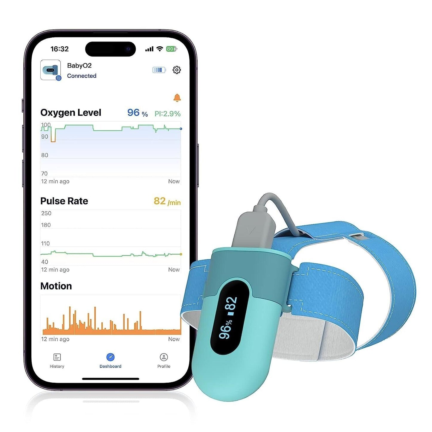 Babyphone Baby Pulsoximeter mit Alarm Überwachen Sauerstoffsättigung Herzfrequen
