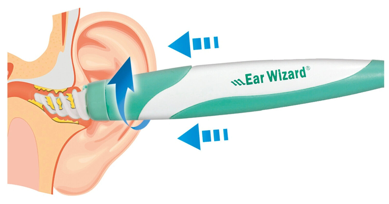  Ear Wizard Saubere Ohren im Handumdrehen 